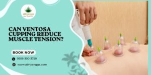 Can Ventosa Cupping Reduce Muscle Tension?
